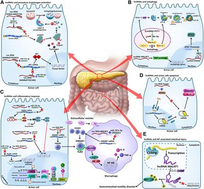 Role of lncRNAs in acute pancreatitis: pathogenesis, diagnosis, and therapy